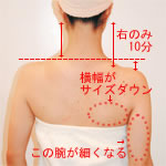施術の様子