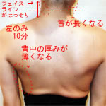 施術の様子
